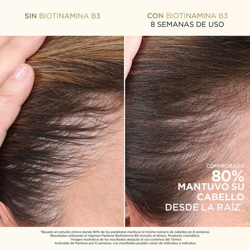 Shampoo Anticaída+ Pantene Biotinamina B3 Para Cabello Débil 300 Ml